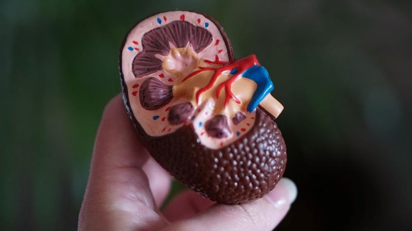 A model of human kidney