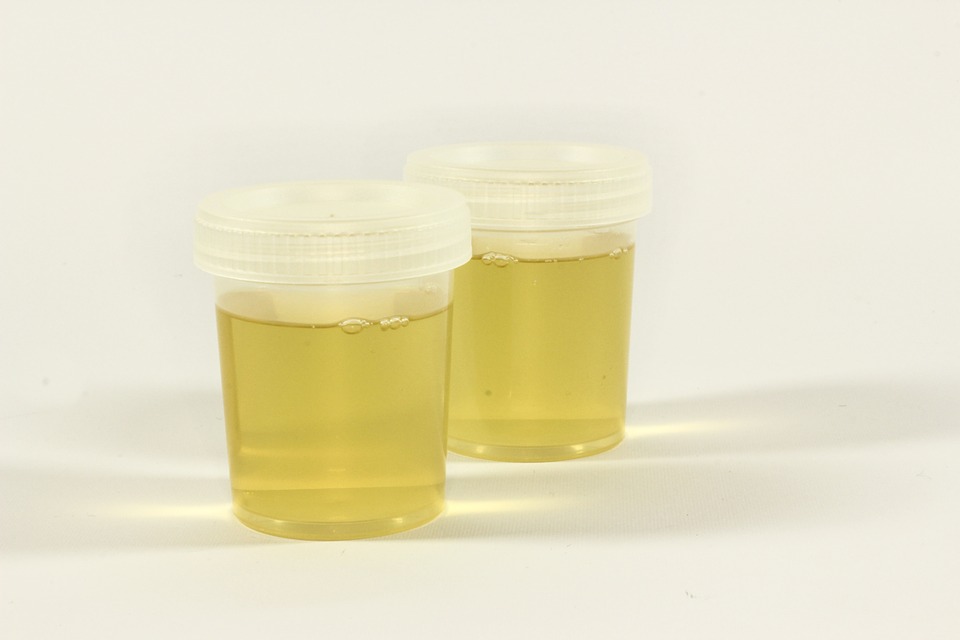 Urine samples