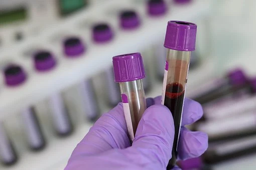 lab worker holding blood samples