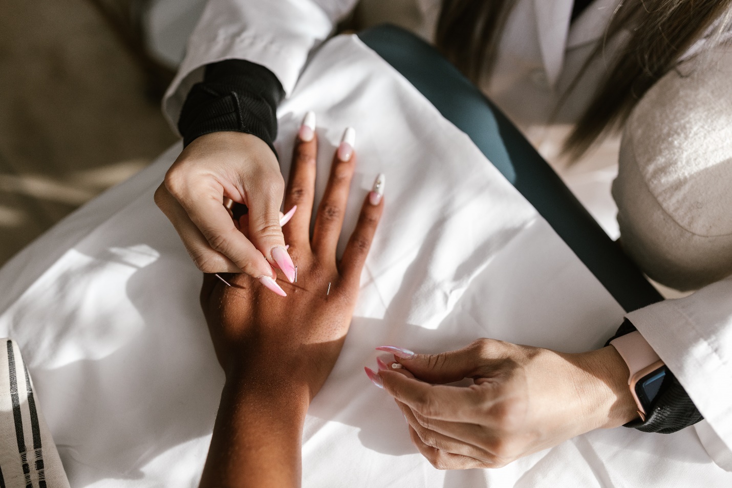 Acupuncture – fear of needles – Maryland