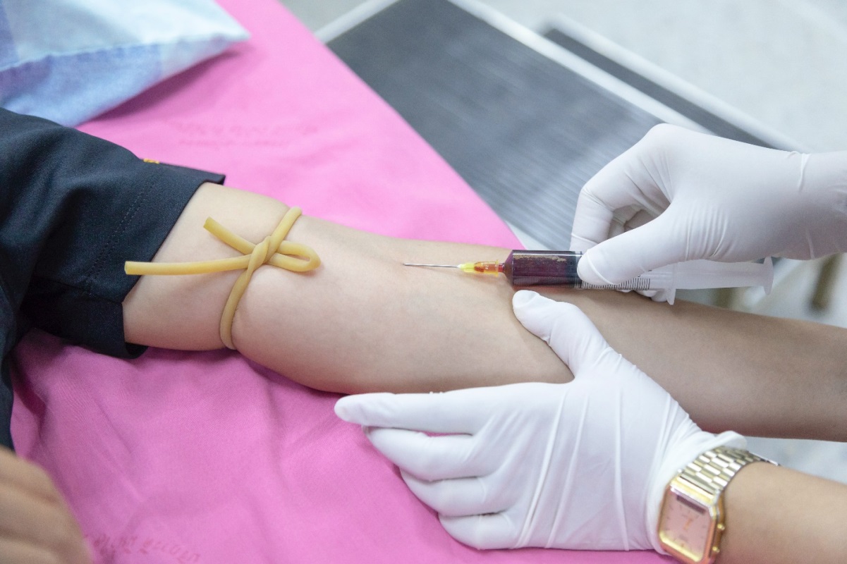 a person offering mobile blood testing services in Alexandria