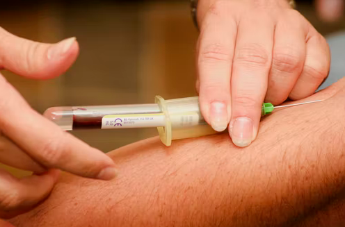 A phlebotomist inserts a needle to get a patient's blood