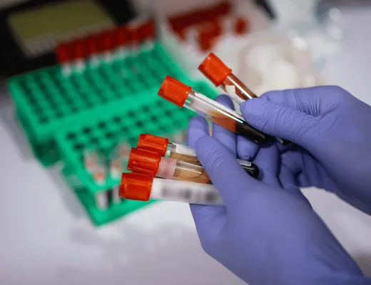 mobile blood draw services in Maryland for patients and care organizations