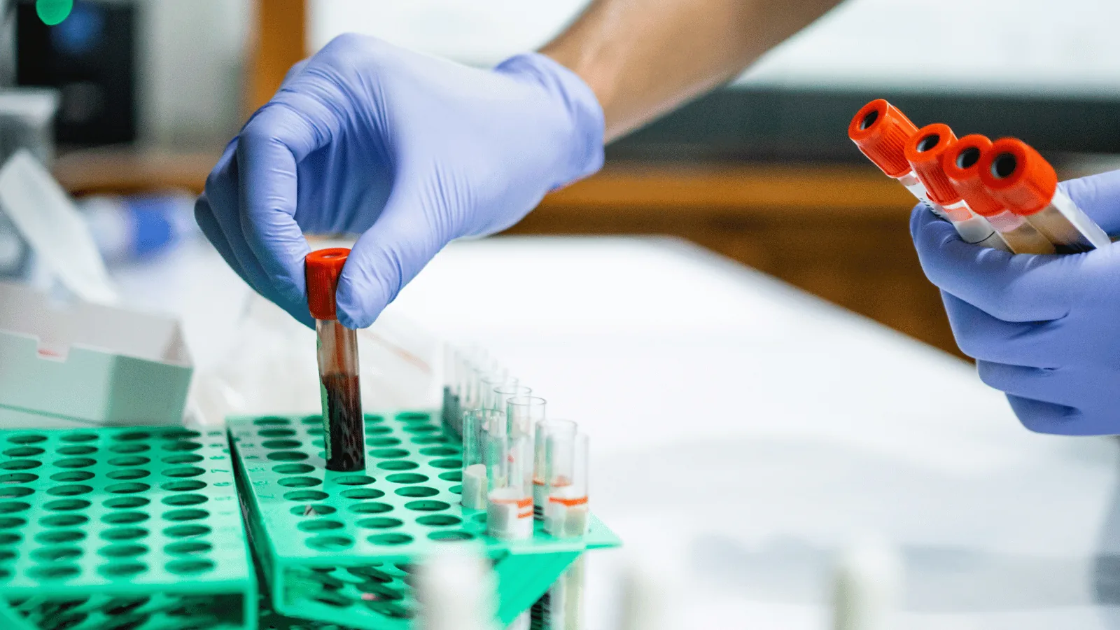 mobile blood draw services in Washington DC, certified phlebotomist at a home visit