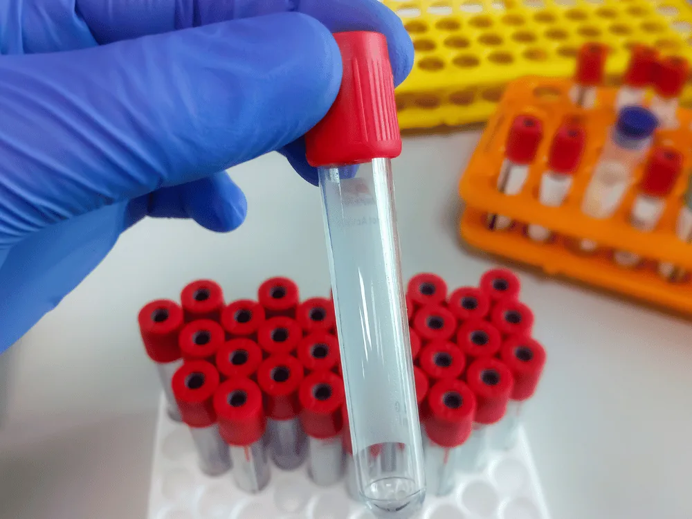 routine blood draw service Maryland, certified phlebotomist collecting a sample for a scheduled checkup