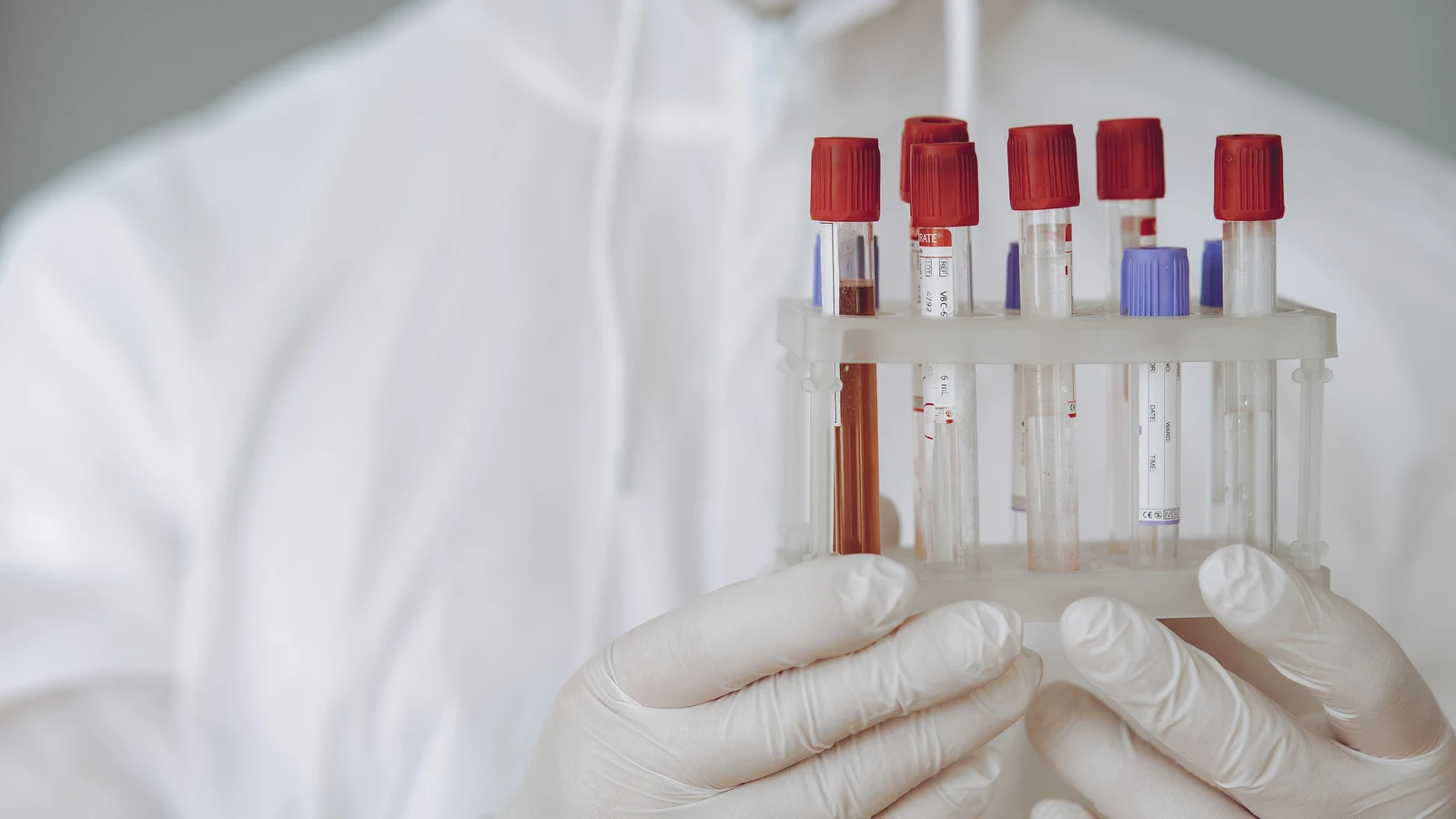 Standing order blood draw at home service in Washington DC