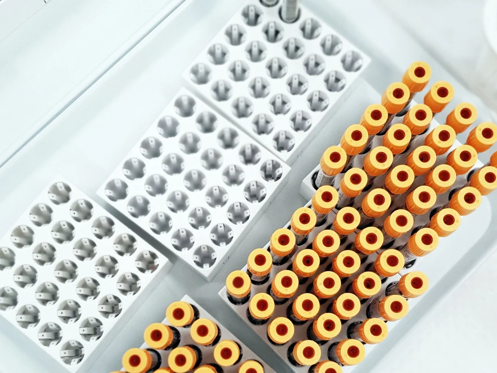 What is a standing order blood draw in Washington DC