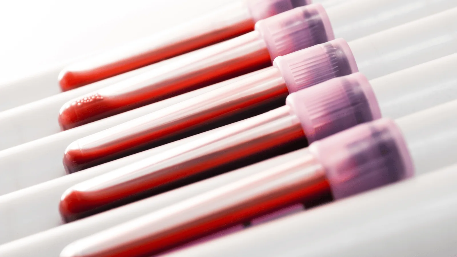 therapeutic phlebotomy in Maryland, certified phlebotomist performing an at home treatment