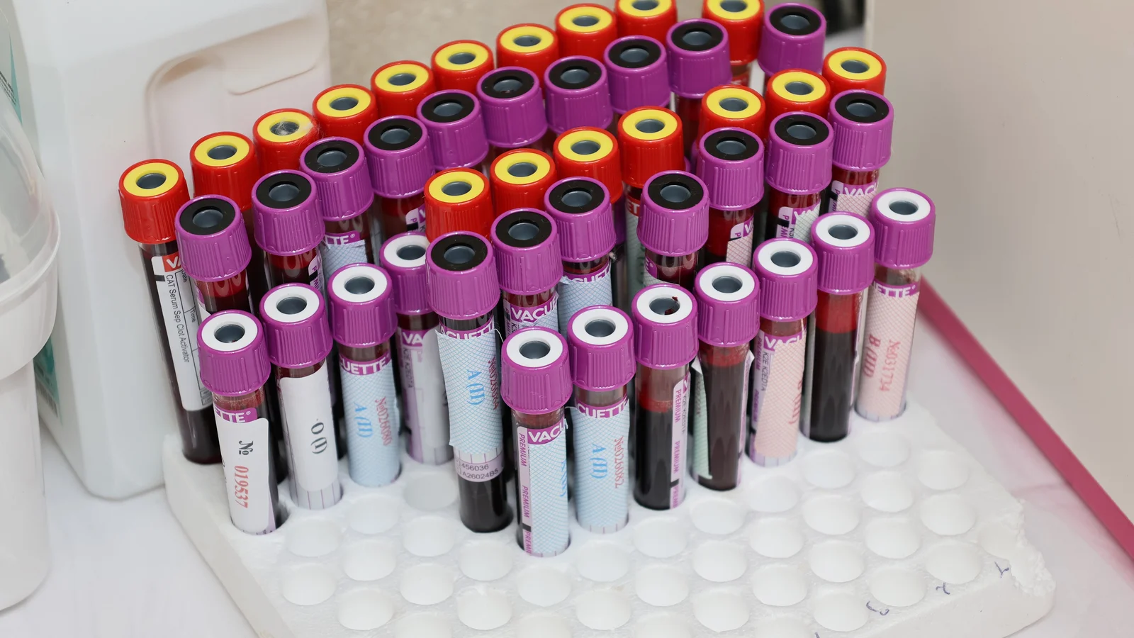 Therapeutic phlebotomy at home service in Washington DC