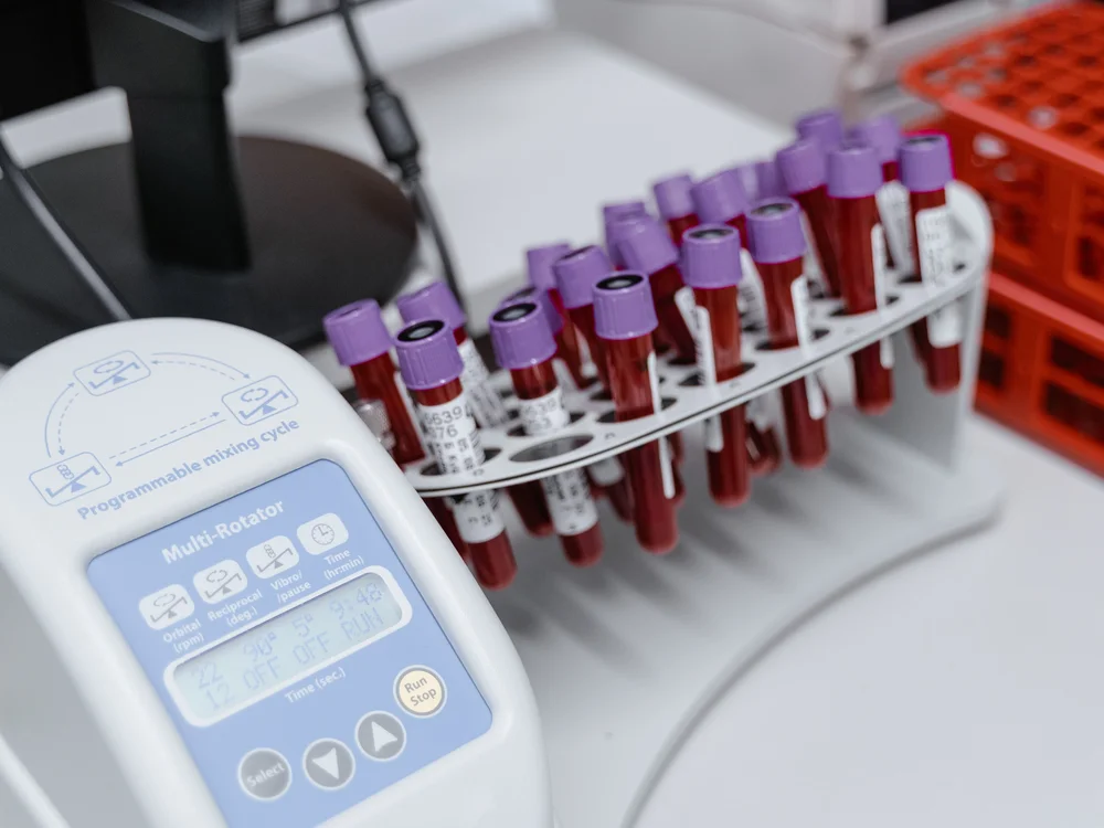 Therapeutic phlebotomy under medical supervision in Washington DC