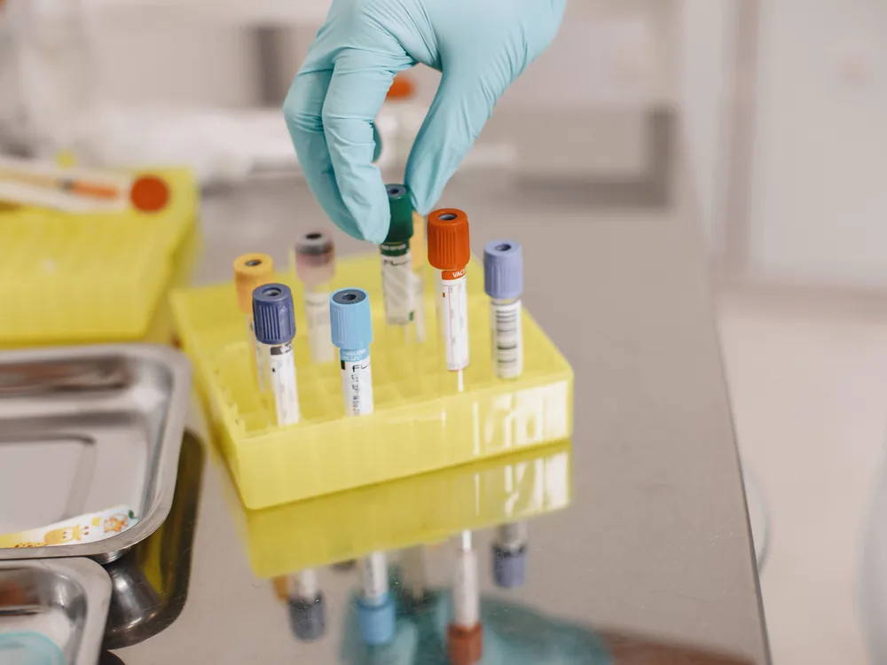 mobile phlebotomy services in Virginia, certified phlebotomist selecting labeled specimen tubes for a mobile blood draw