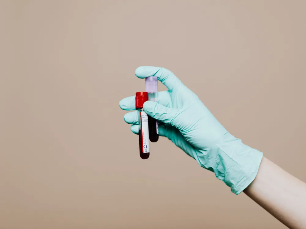 routine blood draw service in Virginia, gloved technician holding labeled blood specimen tubes