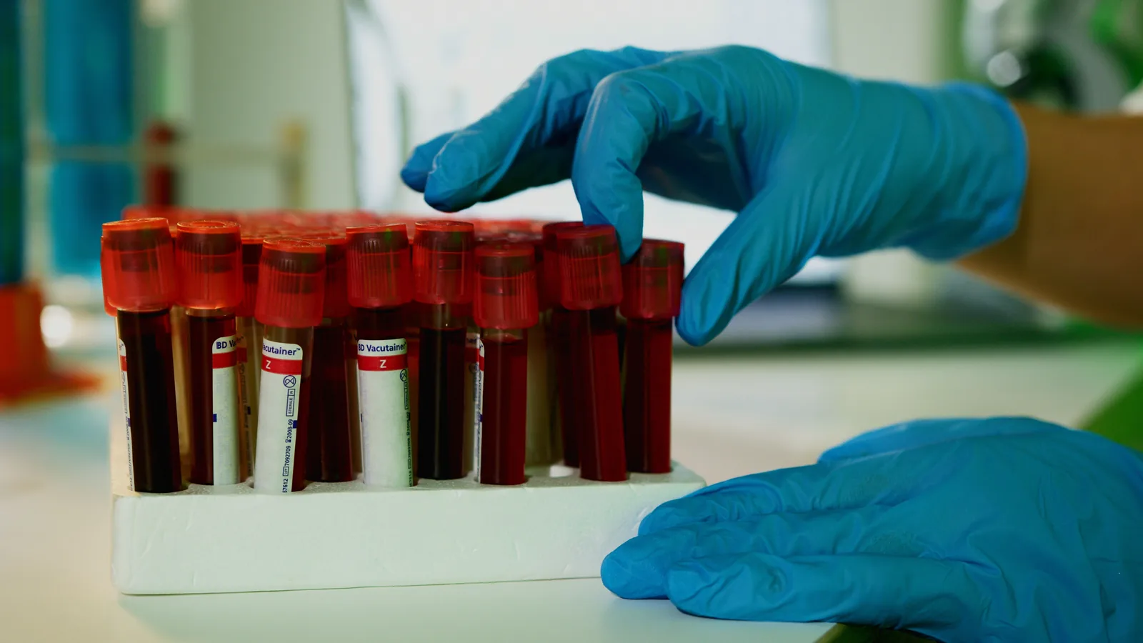 stat blood draw service in Virginia, phlebotomist reaching for a rack of urgent specimen tubes