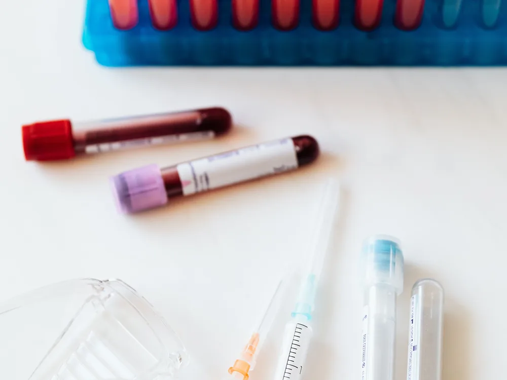 stat blood draw service in Virginia, collection tubes and syringes staged for urgent specimen draw
