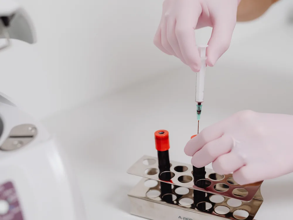 therapeutic phlebotomy Virginia, medically supervised blood removal treatment at home